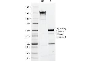 SDS-PAGE Analysis Purified EpCAM Mouse Monoclonal Antibody (EGP40/1110). (EpCAM anticorps  (Cytoplasmic Domain))