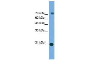 WB Suggested Anti-MAPK6 Antibody Titration: 0. (MAPK6 anticorps  (Middle Region))