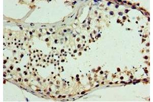 Immunohistochemistry of paraffin-embedded human testis tissue using ABIN7147719 at dilution of 1:100 (CHD2 anticorps  (AA 1569-1828))