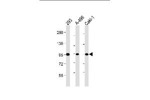 All lanes : Anti-Nephrin  antibody at 1:2000 dilution Lane 1: 293 whole cell lysate Lane 2: A-498 whole cell lysate Lane 3: Caki-1 whole cell lysate Lysates/proteins at 20 μg per lane.