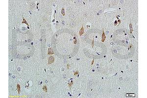 Formalin-fixed and paraffin embedded rat brain tissue labeled with Rabbit Anti-NGF-beta Polyclonal Antibody (ABIN724430) at 1:200 followed by conjugation to the secondary antibody and DAB staining. (NGFB anticorps  (AA 151-220))