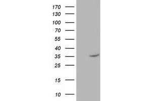 Western Blotting (WB) image for anti-Nudix (Nucleoside Diphosphate Linked Moiety X)-Type Motif 6 (NUDT6) antibody (ABIN1499868) (NUDT6 anticorps)