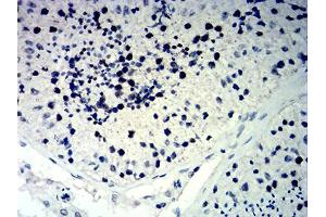 Immunohistochemical analysis of paraffin-embedded testis tissues using CDKN1C mouse mAb with DAB staining.