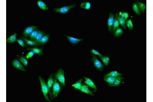 Immunofluorescent analysis of HepG2 cells using ABIN7143550 at dilution of 1:100 and Alexa Fluor 488-congugated AffiniPure Goat Anti-Rabbit IgG(H+L)