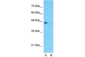 Host:  Rabbit  Target Name:  GPR177  Sample Type:  Human Fetal Liver  Lane A:  Primary Antibody  Lane B:  Primary Antibody + Blocking Peptide  Primary Antibody Concentration:  1ug/ml  Peptide Concentration:  5ug/ml  Lysate Quantity:  25ug/lane/lane  Gel Concentration:  0.