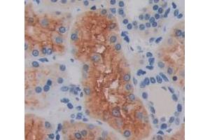Used in DAB staining on fromalin fixed paraffin- embedded Kidney tissue