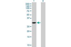 Western Blot analysis of CMBL expression in transfected 293T cell line by CMBL MaxPab polyclonal antibody. (CMBL anticorps  (AA 1-245))