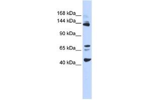 WB Suggested Anti-BRD8 Antibody Titration:  0. (BRD8 anticorps  (Middle Region))