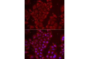 Immunofluorescence analysis of U2OS cells using TPP2 antibody. (Tpp2 anticorps)
