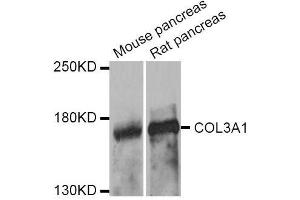 Western blot analysis of extracts of various cell lines, using COL3A1 antibody. (COL3A1 anticorps  (AA 1217-1466))