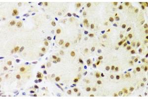 Immunohistochemistry of paraffin-embedded Human stomach using PRPF3 Polyclonal Antibody at dilution of 1:100 (40x lens). (PRPF3 anticorps)