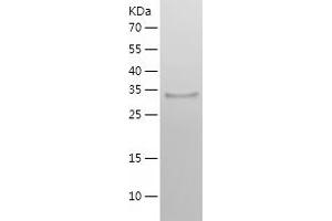 Western Blotting (WB) image for Starch Binding Domain 1 (STBD1) (AA 24-358) protein (His tag) (ABIN7125209)