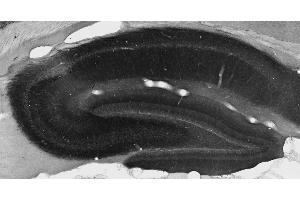 Adult rat hippocampal immunohistochemistry. (KCNT2 anticorps  (AA 564-624))