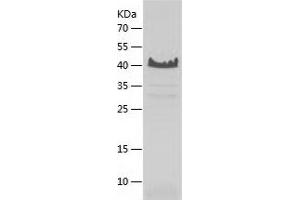 Western Blotting (WB) image for Nascent Polypeptide Associated Complex alpha 1 (NACa1) (AA 1-215) protein (His tag) (ABIN7124113)