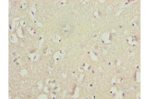 Immunohistochemistry of paraffin-embedded human brain tissue using ABIN7145497 at dilution of 1:100 (GLB1L2 anticorps  (AA 401-636))