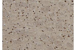 ABIN6267208 at 1/100 staining Rat brain tissue by IHC-P.