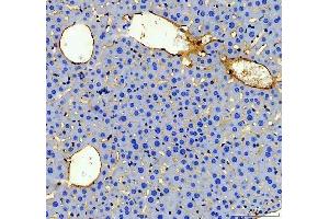 IHC analysis of CD31 using anti-CD31 antibody (ABIN5692990).