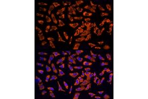 anti-Epidermal Growth Factor Receptor Pathway Substrate 15 (EPS15) (AA 660-840) antibody