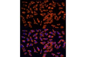 Immunofluorescence analysis of U2OS cells using EPS15 Rabbit pAb  at dilution of 1:200 (40x lens). (EPS15 anticorps  (AA 660-840))