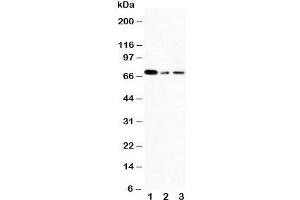 Western blot testing of XRCC1 antibody and Lane 1:  293T;  2: A431;  3: HeLa cell lysate. (XRCC1 anticorps  (N-Term))