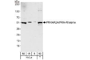 Western Blotting (WB) image for anti-Protein Kinase, CAMP-Dependent, Regulatory, Type II, alpha (PRKAR2A) (AA 50-100) antibody (ABIN7454771)