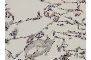 Immunoperoxidase of monoclonal antibody to ARNT on formalin-fixed paraffin-embedded human lung.