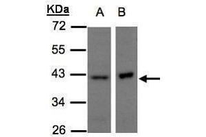 WB Image Sample(30 μg of whole cell lysate) A:H1299 B:Raji, 10% SDS PAGE antibody diluted at 1:500 (NDUFA10 anticorps  (Center))