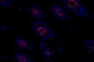 Immunofluorescent analysis of paraformaldehyde-fixed mouse skin using,alpha Actinin (ABIN7073023) at dilution of 1: 500 (alpha Actinin anticorps)