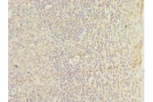 Immunohistochemistry of paraffin-embedded human tonsil tissue using ABIN7172948 at dilution of 1:100 (TM9SF3 anticorps  (AA 133-300))