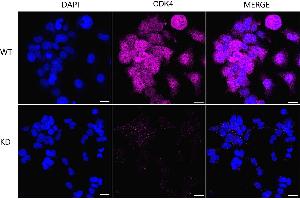 Immunocytochemical staining of HeLa cells using CDK4 antibody (ABIN7798214), 1:1,000), Top panel: wild-type (WT), Bottom panal: CDK4 shRNA knockdown (KD). (Recombinant CDK4 anticorps)