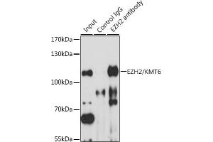 Immunoprecipitation analysis of 200 μg extracts of HT-29 cells, using 3 μg EZH2/KMT6 antibody (ABIN6133510, ABIN6140394, ABIN6140397 and ABIN6218016). (EZH2 anticorps  (AA 50-150))