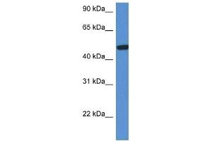 Western Blot showing HEXA antibody used at a concentration of 1 ug/ml against Fetal Kidney Lysate