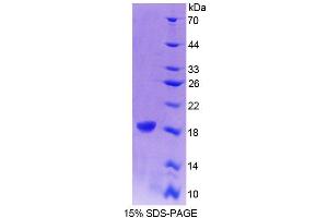 SDS-PAGE analysis of Human CRABP1 Protein. (CRABP1 Protéine)