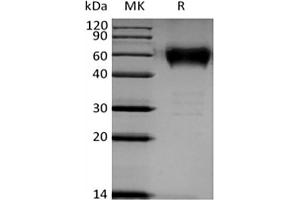 Western Blotting (WB) image for B and T Lymphocyte Associated (BTLA) protein (mFc Tag) (ABIN7319775)