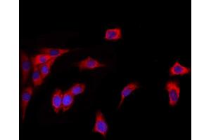ABIN6260454 and ABIN6272856 staining HepG2 by IF/ICC. (Caprin-1 anticorps  (Internal Region))