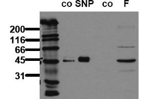 Western Blotting (WB) image for anti-Vasodilator-Stimulated phosphoprotein (VASP) (pSer239) antibody (ABIN126913) (VASP anticorps  (pSer239))