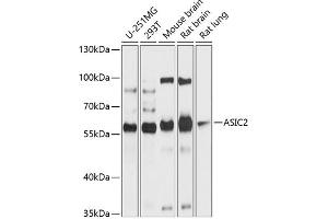 Western blot analysis of extracts of various cell lines, using  antibody (ABIN6129939, ABIN6137189, ABIN6137190 and ABIN6214773) at 1:1000 dilution. (ACCN1 anticorps  (AA 120-400))