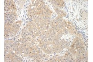 Immunohistochemistry (IHC) image for anti-E3 ubiquitin-protein ligase NEDD4-like (NEDD4L) (AA 275-325) antibody (ABIN7448685) (NEDD4-2 anticorps  (AA 275-325))