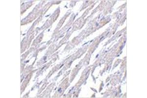 Immunohistochemistry of CRTH2 in human heart tissue with CRTH2 antibody at 2. (Prostaglandin D2 Receptor 2 (PTGDR2) (Center) anticorps)