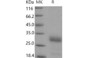 Western Blotting (WB) image for Insulin-Like Growth Factor Binding Protein 6 (IGFBP6) (Active) protein (His tag) (ABIN7196219)