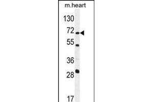 NT5C1B Antibody (N-term) (ABIN654258 and ABIN2844078) western blot analysis in mouse heart tissue lysates (35 μg/lane).