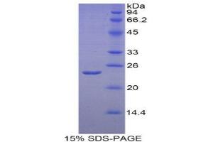 SDS-PAGE (SDS) image for Endothelial PAS Domain Protein 1 (EPAS1) (AA 339-541) protein (His tag) (ABIN1877550)