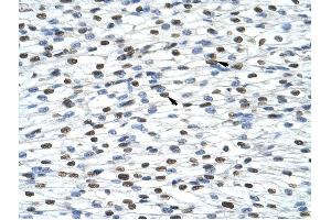 HNRPA0 antibody was used for immunohistochemistry at a concentration of 4-8 ug/ml to stain Myocardial cells (arrows) in Human Heart. (HNRNPA0 anticorps  (Middle Region))