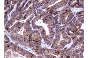 anti-Antigen Identified By Monoclonal Antibody Ki-67 (MKI67) (AA 2924-3256) antibody