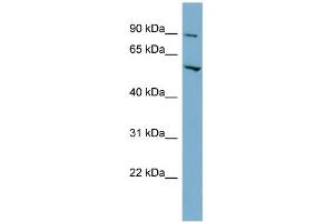WB Suggested Anti-MFSD1 Antibody Titration:  0. (MFSD1 anticorps  (Middle Region))