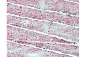 Anti-MNSOD / SOD2 antibody IHC staining of human skeletal muscle. (SOD2 anticorps)