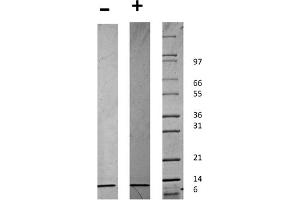 SDS-PAGE of Human Beta-cell Attracting Chemokine 1 (CXCL13) Recombinant Protein SDS-PAGE of Human Beta-cell Attracting Chemokine 1 (CXCL13) Recombinant Protein. (CXCL13 Protéine)