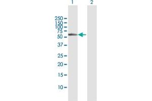Western Blot analysis of BBS4 expression in transfected 293T cell line by BBS4 MaxPab polyclonal antibody. (BBS4 anticorps  (AA 1-519))