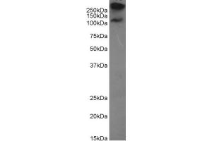 Western Blot using anti-MUC1 antibody HMFG2.