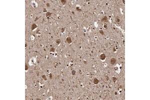 Immunohistochemical staining of human hippocampus with SEZ6 polyclonal antibody  shows cytoplasmic positivity in neurons at 1:20-1:50 dilution. (SEZ6 anticorps)